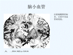 脑小血管病概念与治疗课件.ppt