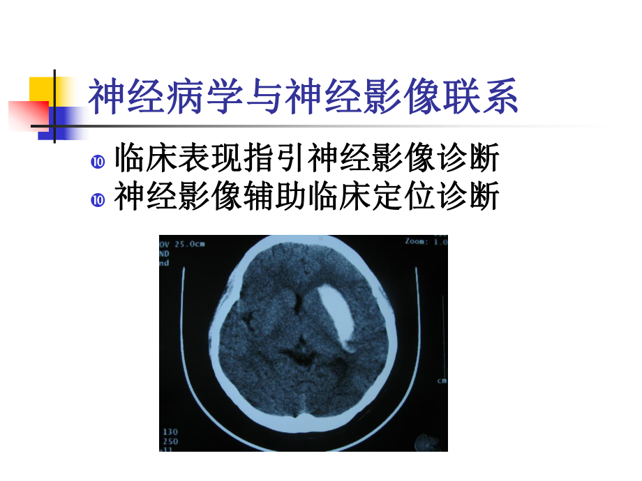 神经病学教学课件-失语失用.ppt_第3页