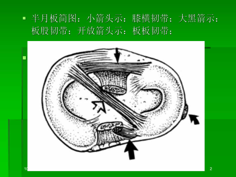 膝关节MRI解剖和损伤培训课件.ppt_第2页