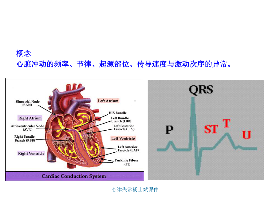 心律失常课件1.ppt_第3页