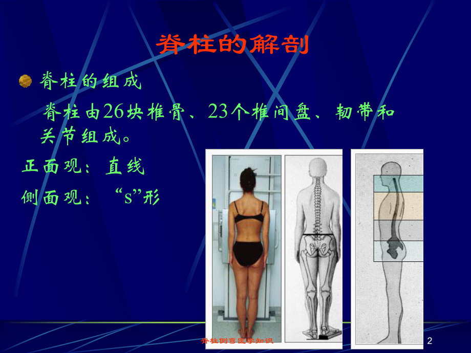 脊柱侧弯医学知识培训课件.ppt_第2页