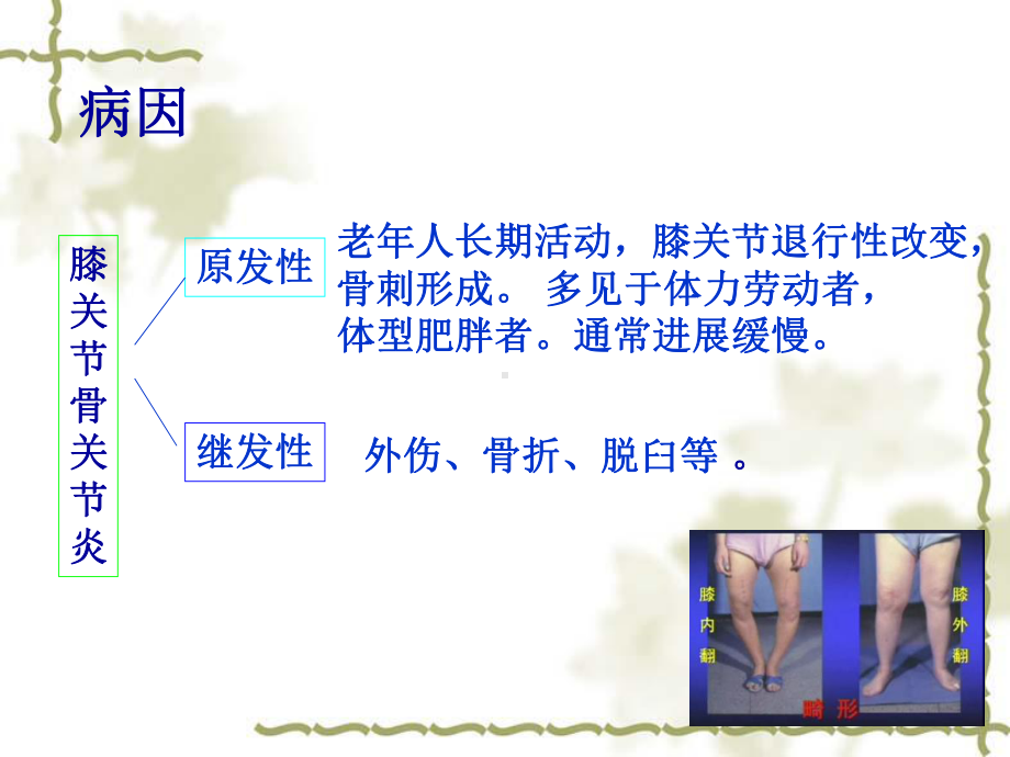 膝关节骨性关节炎汇编课件.ppt_第3页