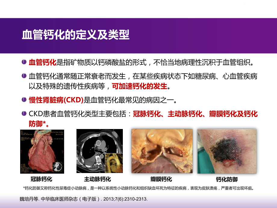 重视高磷血症的治疗防治血管钙化课件-2.pptx_第3页