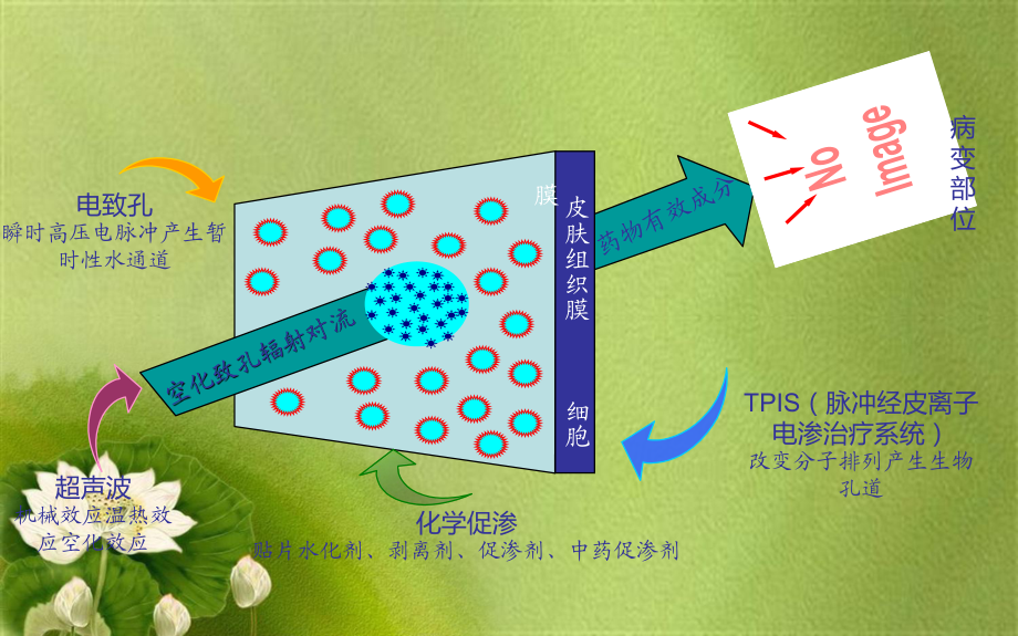 超声药物透入疗法对临床常见痛症的治疗优秀课件.pptx_第3页