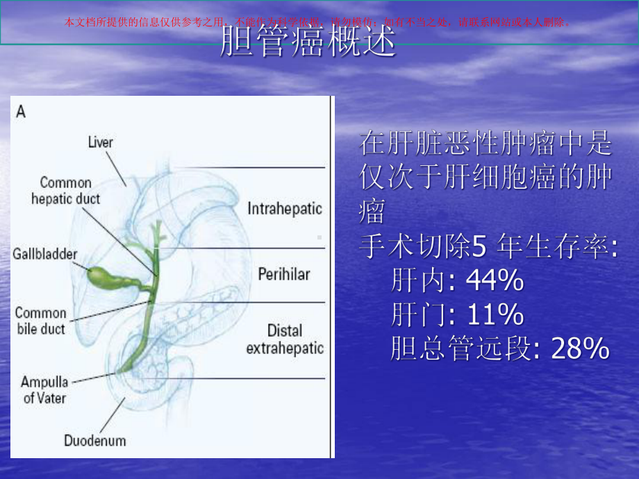 胆管癌的CT诊断培训课件.ppt_第1页