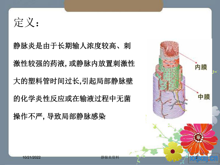 静脉炎培训课件.ppt_第2页