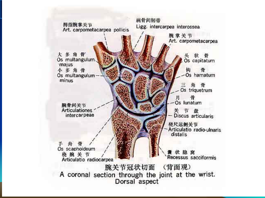 腕关节MR医学宣教课件.ppt_第2页