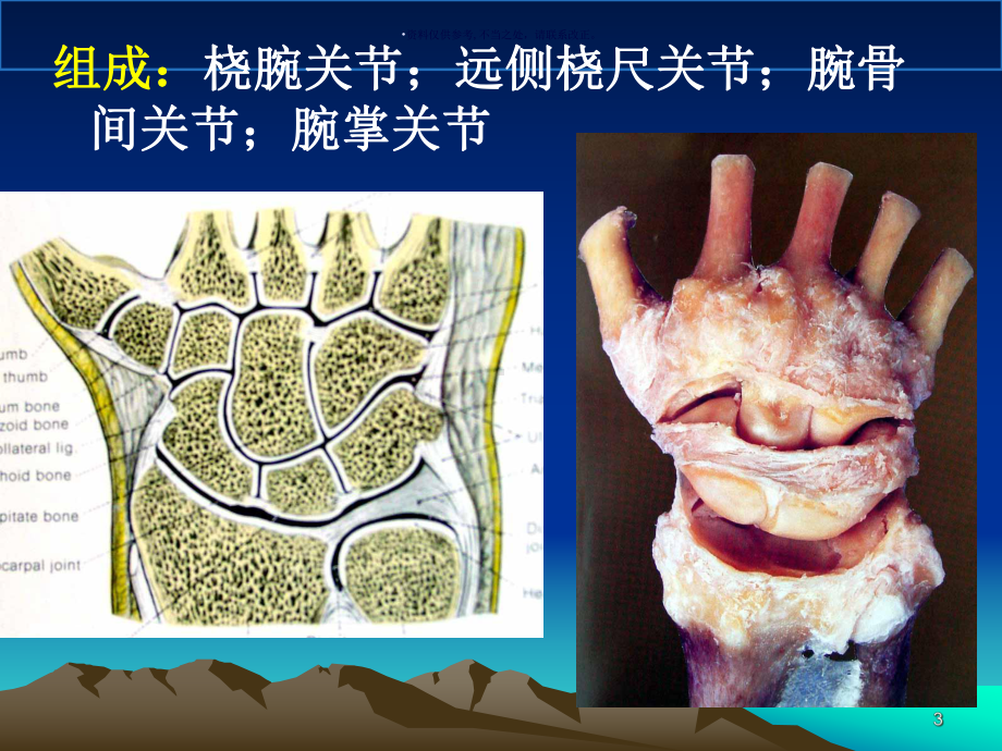 腕关节MR医学宣教课件.ppt_第3页