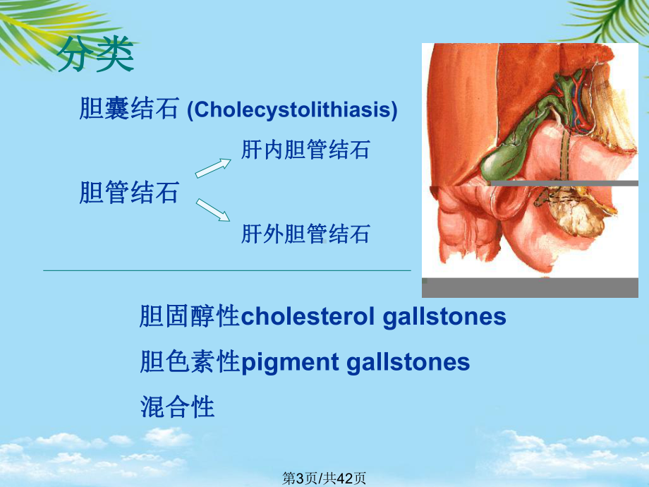 胆石症课件全面版.pptx_第3页