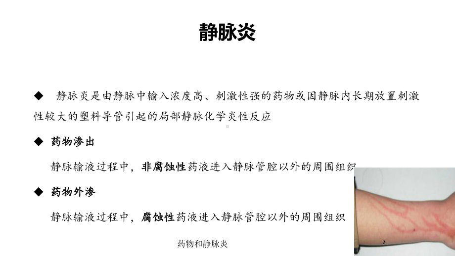 药物和静脉炎培训课件.ppt_第2页