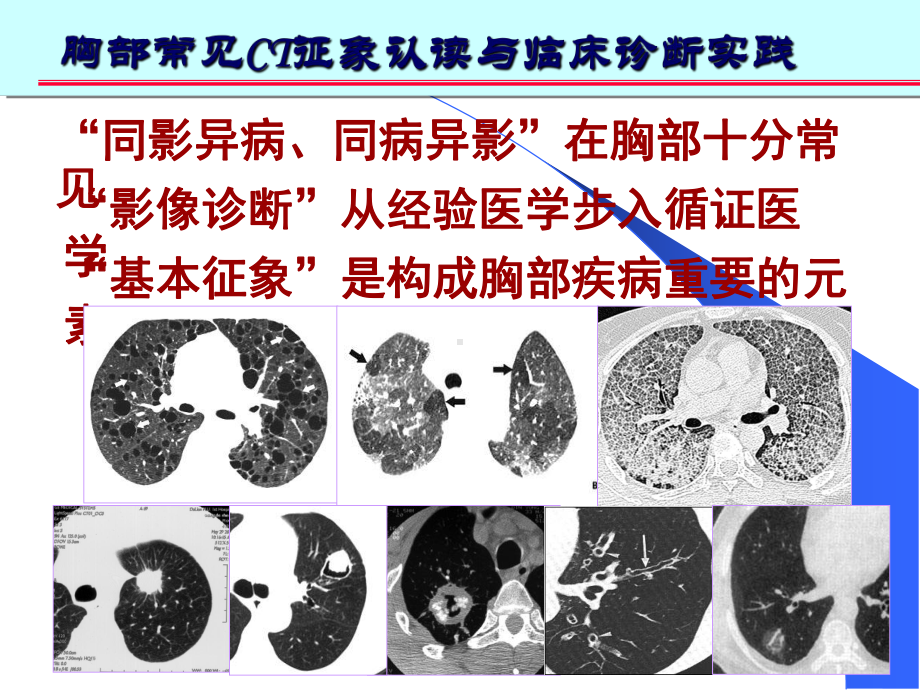 胸部常见CT十大征象的诊疗和应用培训课件.ppt_第1页