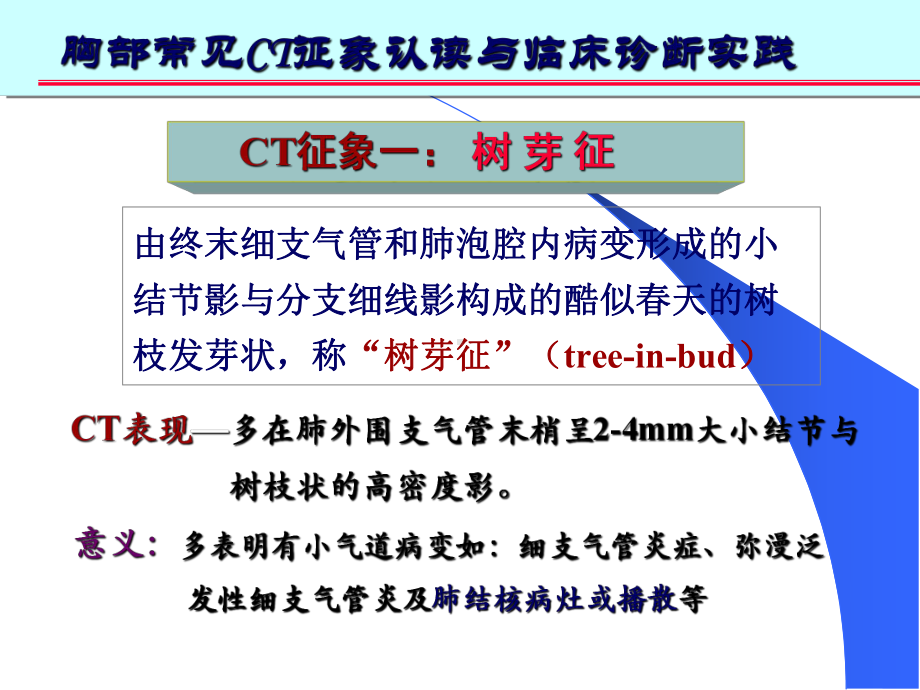 胸部常见CT十大征象的诊疗和应用培训课件.ppt_第2页