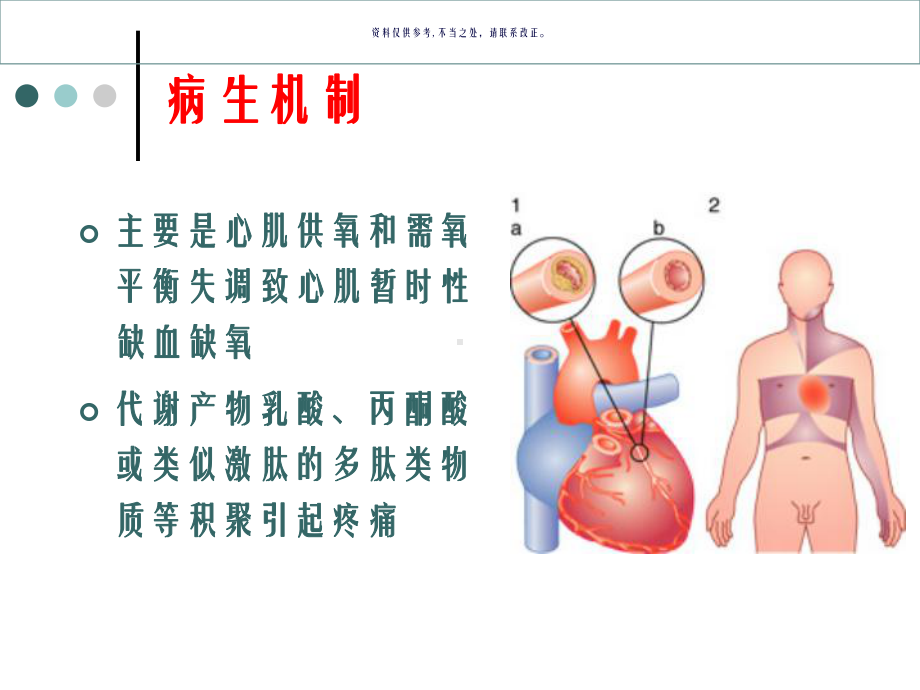 药理学之抗心绞痛课件.ppt_第2页