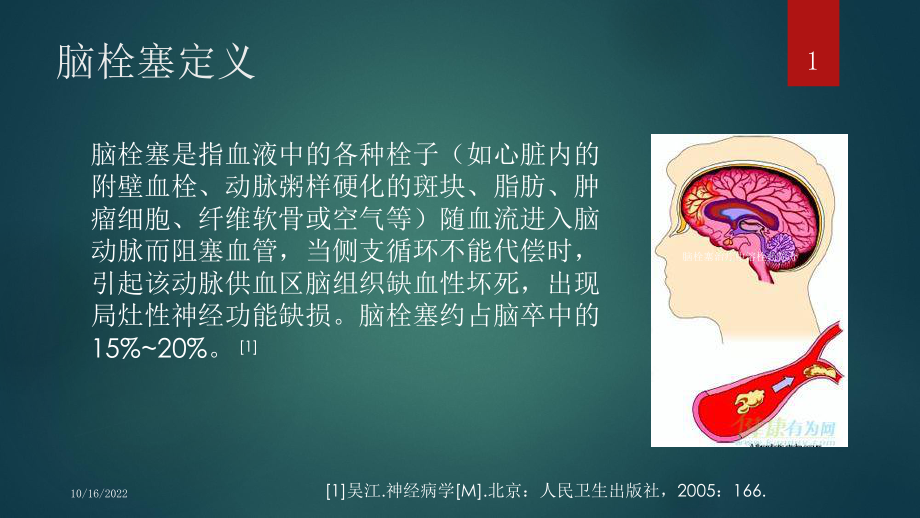 脑栓塞治疗中溶栓药简介培训课件.ppt_第1页