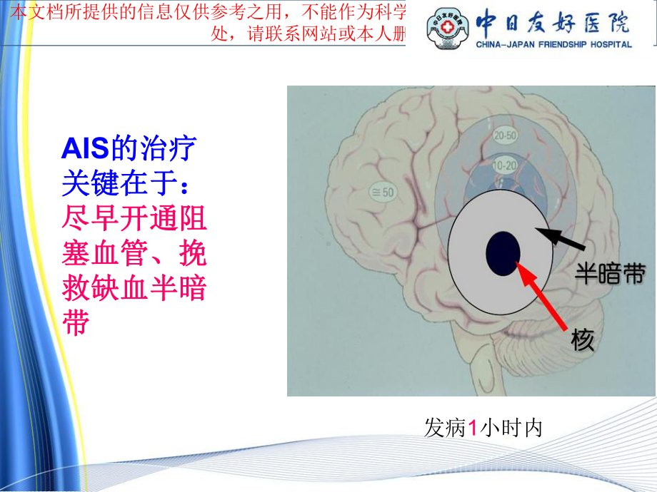 静脉溶栓的医疗护理培训课件.ppt_第2页