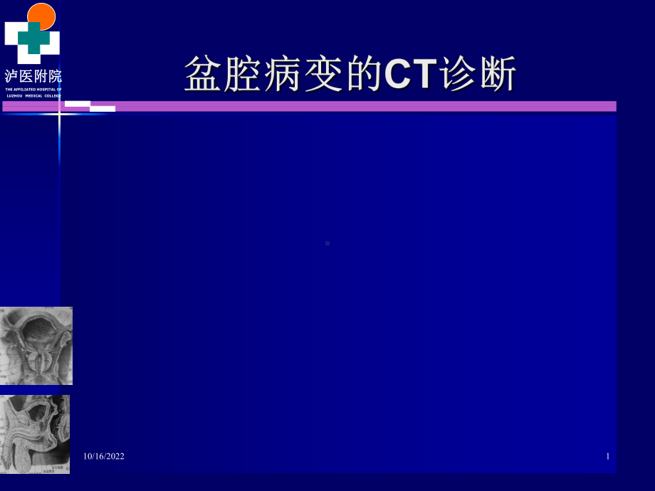 男性生殖系统疾病ct诊断课件.ppt_第1页
