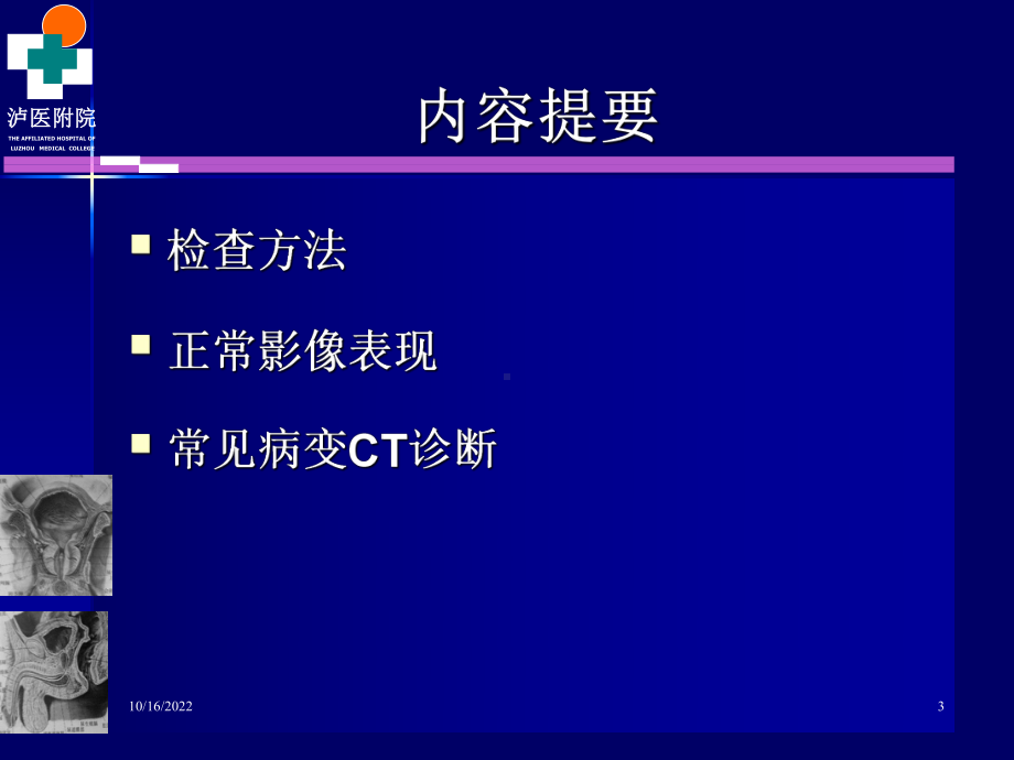 男性生殖系统疾病ct诊断课件.ppt_第3页