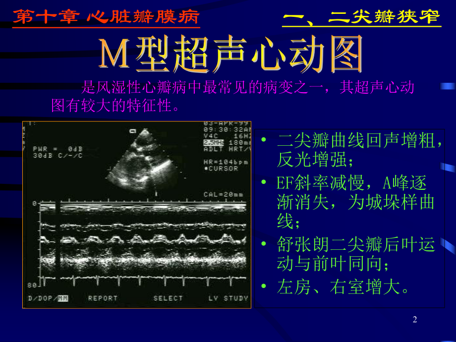 心脏彩超诊断医学课件.ppt_第2页