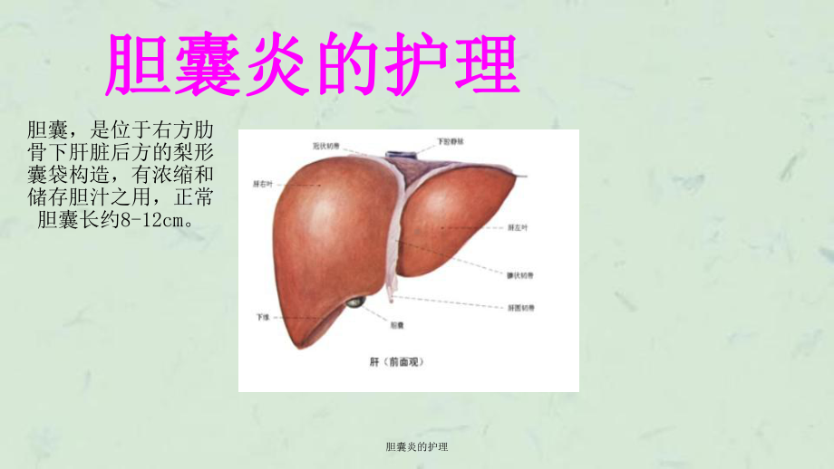 胆囊炎的护理课件.ppt_第2页