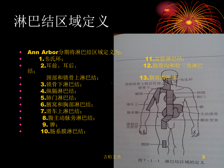 霍奇金淋巴瘤(特制研究)课件.ppt_第3页