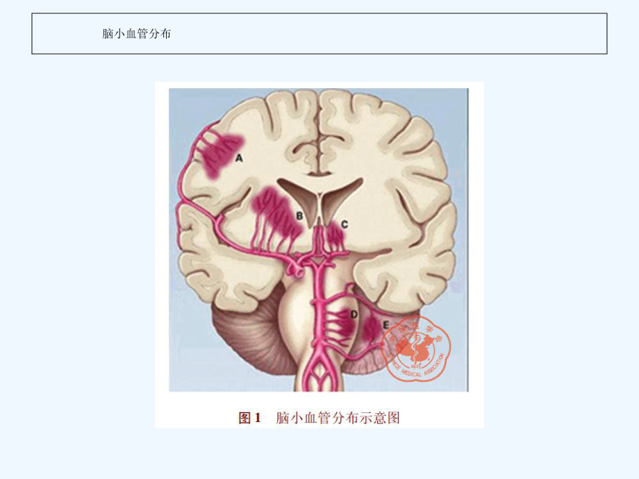 脑小血管病的规范化治疗课件.ppt_第2页