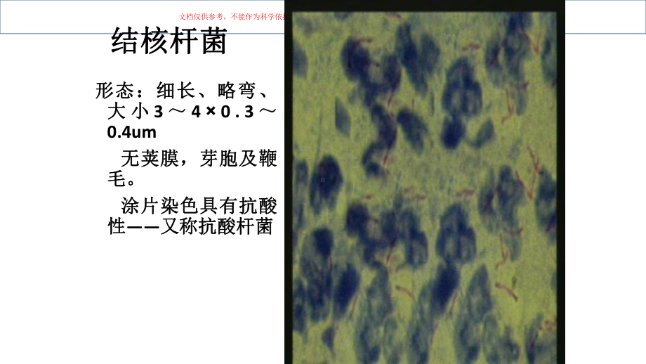 预防结核病医学知识课件.ppt_第2页