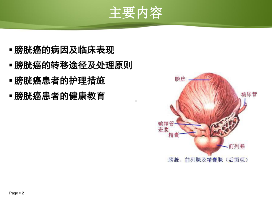 膀胱癌病人护理及健康教育课件.ppt_第2页