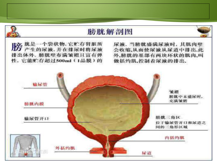 膀胱癌病人护理及健康教育课件.ppt_第3页