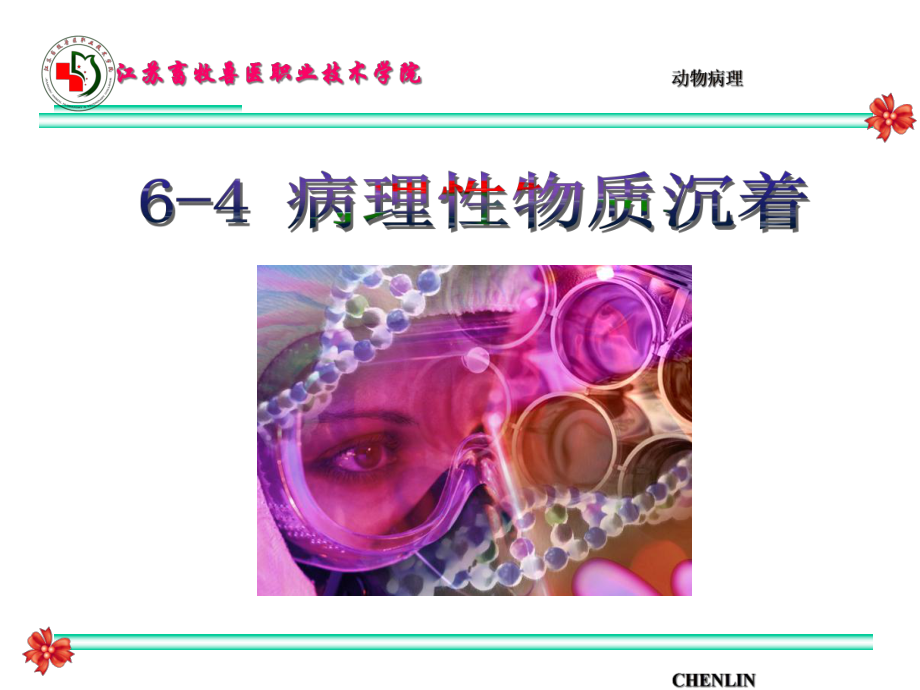 病理性色素沉着和结石-CHENLIN课件.ppt_第1页