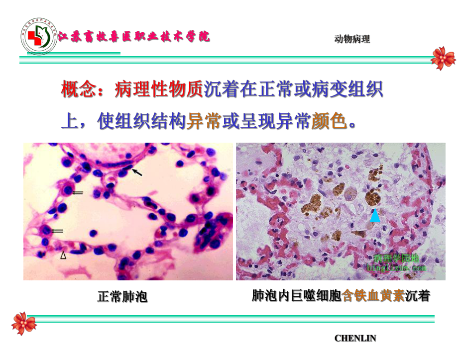 病理性色素沉着和结石-CHENLIN课件.ppt_第2页