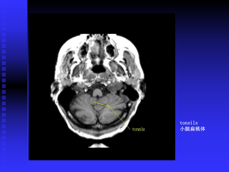 神经影像学培训教课件-.ppt_第2页