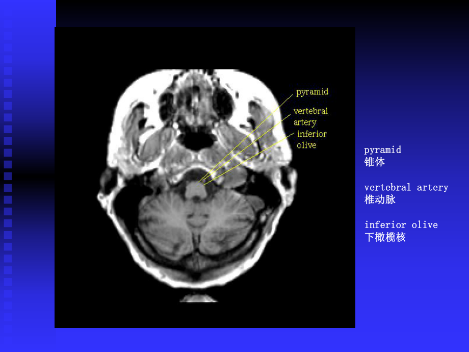 神经影像学培训教课件-.ppt_第3页