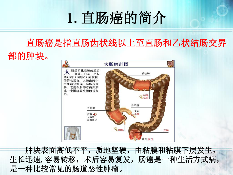 腹腔镜下直肠癌手术配合课件.pptx_第3页