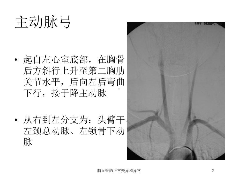 脑血管的正常变异和异常培训课件.ppt_第2页