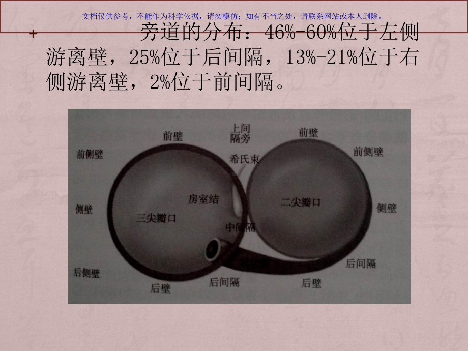 预激综合征体表心电图旁道的定位课件.ppt_第3页