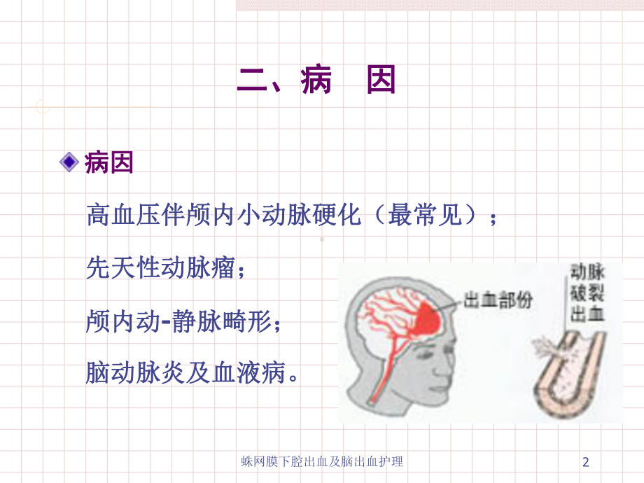 蛛网膜下腔出血及脑出血护理课件.ppt_第2页