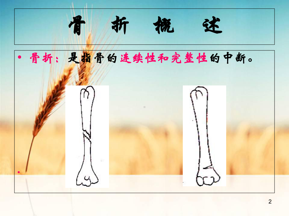 运动系统疾病病人的护理学习课件.ppt_第2页