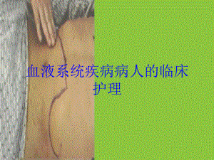 血液系统疾病病人的临床护理培训课件.ppt