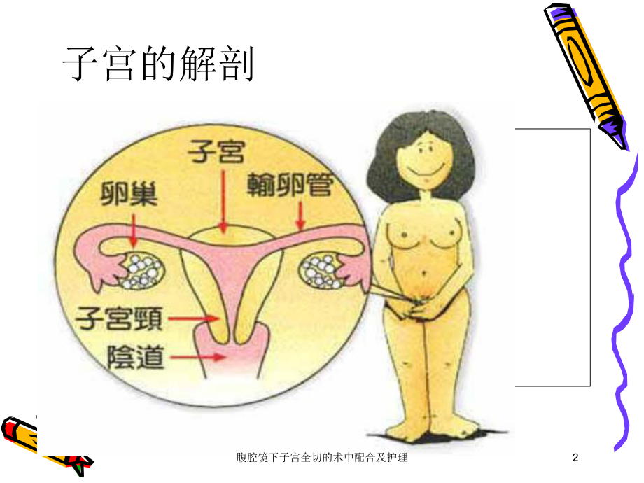 腹腔镜下子宫全切的术中配合及护理培训课件.ppt_第2页