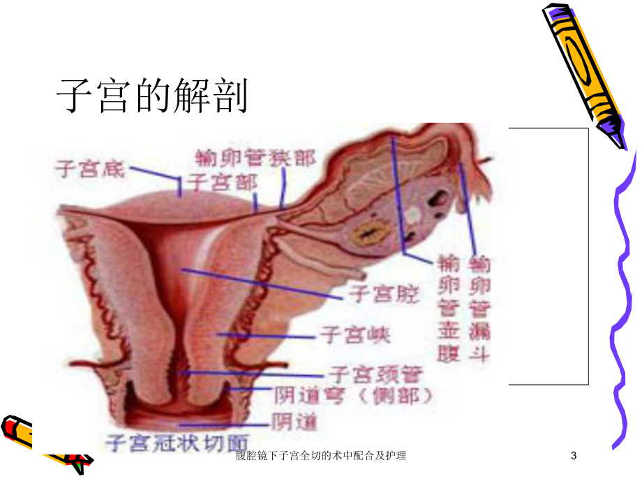 腹腔镜下子宫全切的术中配合及护理培训课件.ppt_第3页