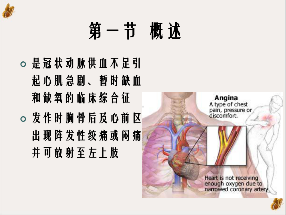 药理学课件之抗心绞痛培训讲义.ppt_第3页