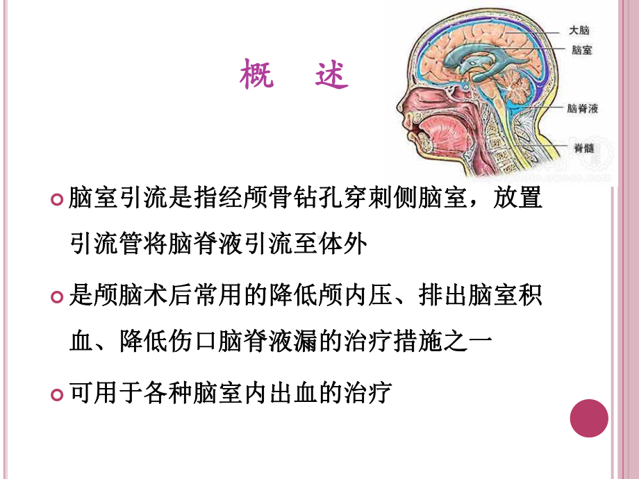 脑室引流管护理课件.ppt_第3页