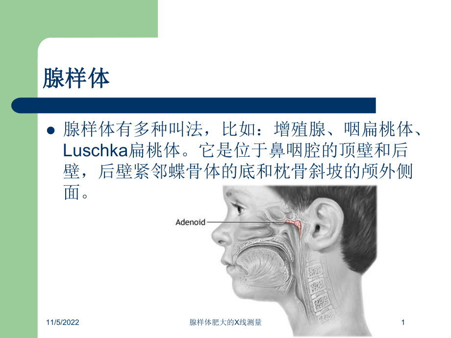 腺样体肥大的X线测量培训课件.ppt_第1页