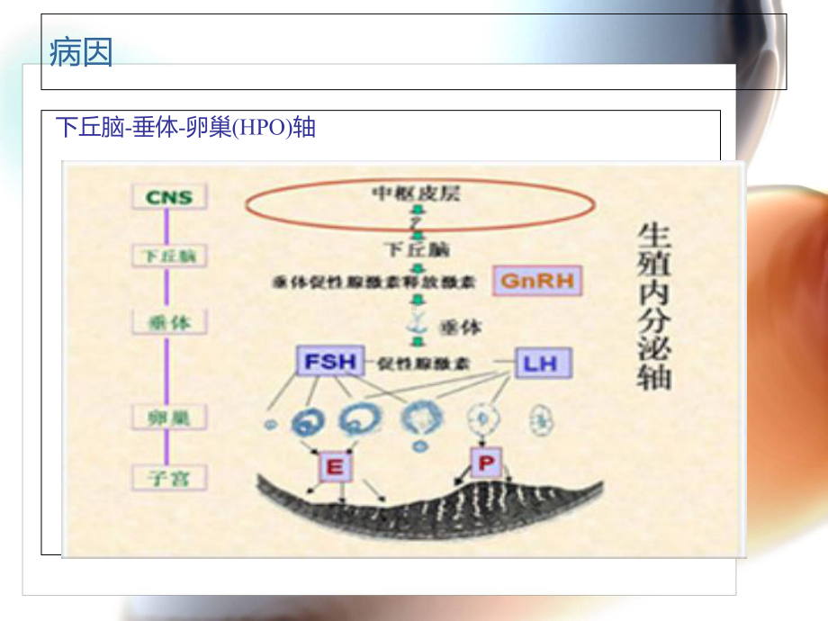 无排卵性功血详解课件.ppt_第3页