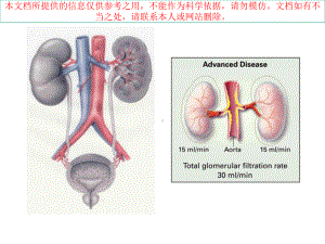 肾动脉狭窄的诊疗和治疗培训课件.ppt