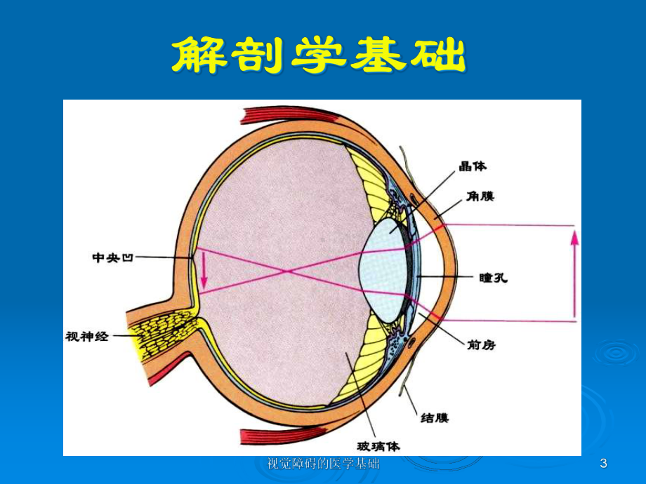 视觉障碍的医学基础课件.ppt_第3页