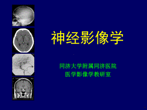 神经影像学课件.ppt