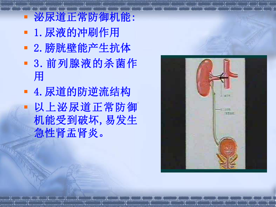 肾盂肾炎-(pyelonephritis)课件.ppt_第2页