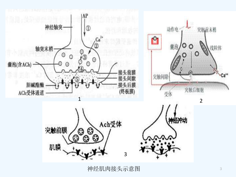 重症肌无力阿尔茨海默病课件.ppt_第3页