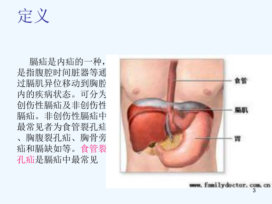 膈疝护理查房课件.ppt_第3页